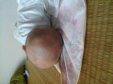 小孩不小心摔跤弄到后腦勺小孩不小心摔跤弄到后腦勺怎么辦？全面解析應對措施