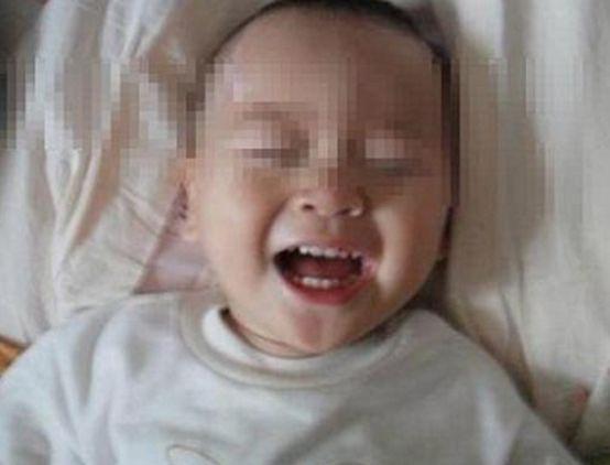 孩子不小心摔倒碰到后腦勺怎么辦孩子不小心摔倒碰到后腦勺怎么辦？家長應(yīng)對策略與注意事項(xiàng)