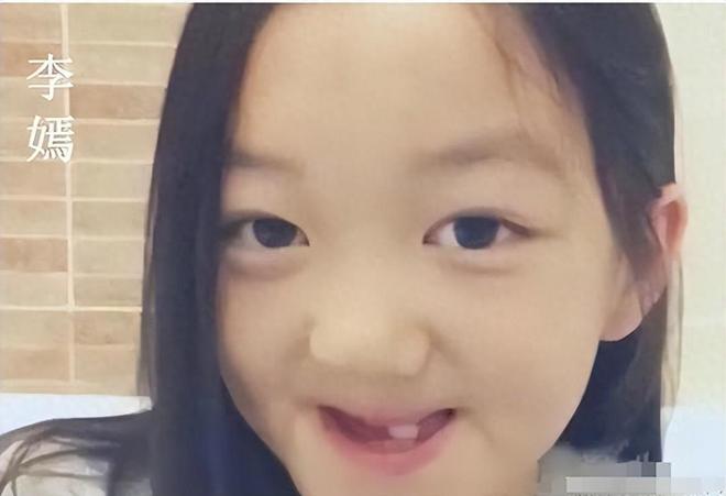 王菲女兒李嫣照片兔唇王菲女兒李嫣照片兔唇，成長中的堅韌與美麗