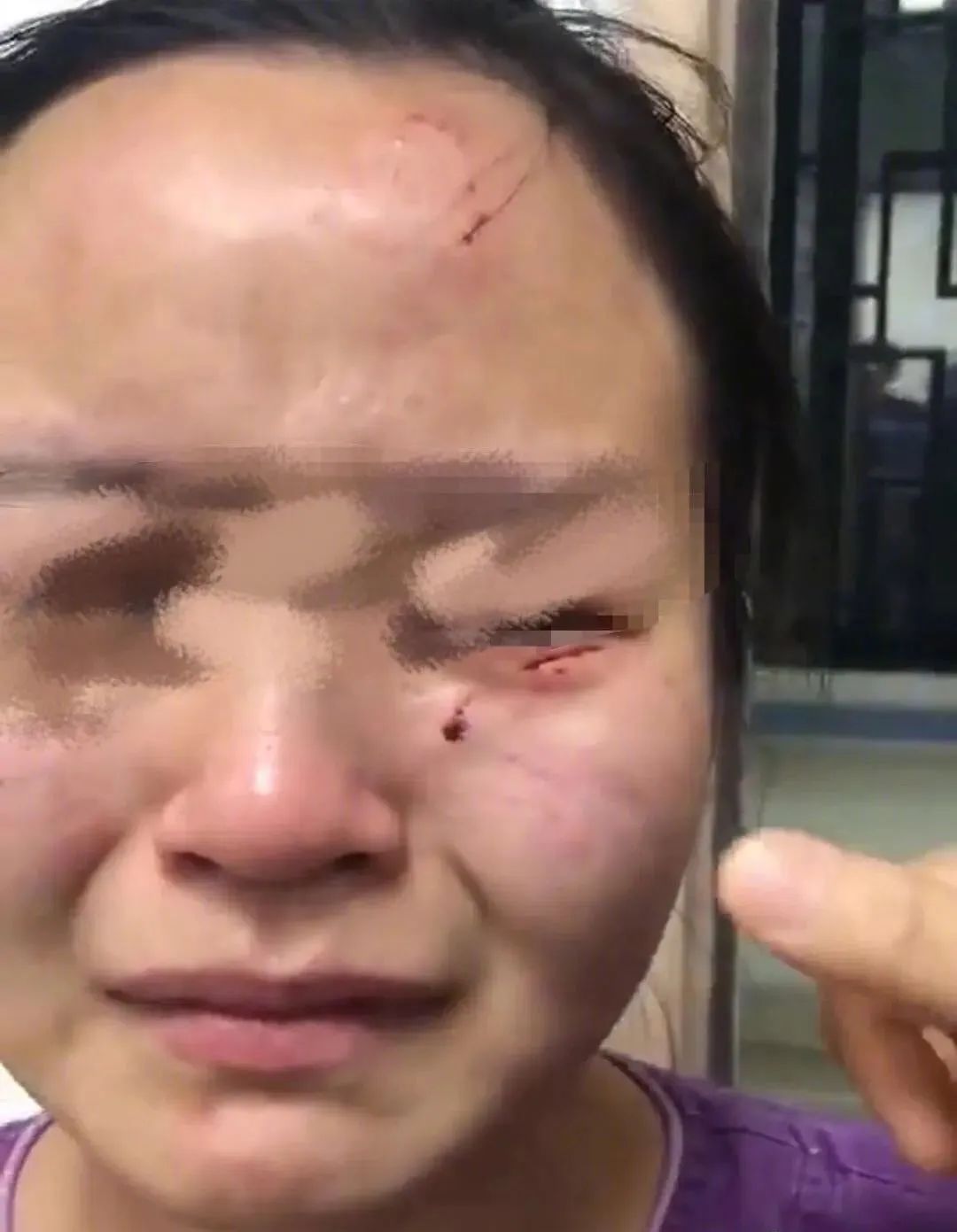 男子持水杯砸傷女同事被刑拘后續(xù)關(guān)于男子持水杯砸傷女同事被刑拘的后續(xù)報(bào)道