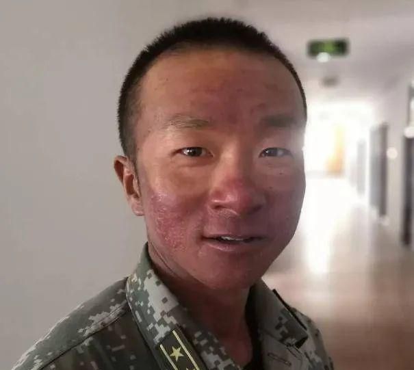 參加閱兵的戰(zhàn)士臉上留下V字曬痕參加閱兵的戰(zhàn)士臉上留下的V字曬痕，榮耀與堅(jiān)韌的象征