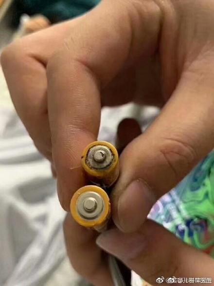 吞入電池會怎么樣如果誤吞電池，可能會對身體造成一定的危害，取決于具體的電池類型以及處理方式。以下是可能出現(xiàn)的情況