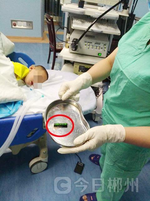 幼兒誤吞電池10小時(shí)致終身殘疾是的，幼兒誤吞電池是一種非常危險(xiǎn)的情況，可能會(huì)導(dǎo)致嚴(yán)重的身體傷害，甚至終身殘疾。電池中的化學(xué)物質(zhì)會(huì)腐蝕食道、胃腸道等器官，造成穿孔、出血、感染等嚴(yán)重后果。如果處理不及時(shí)，還會(huì)危及生命。