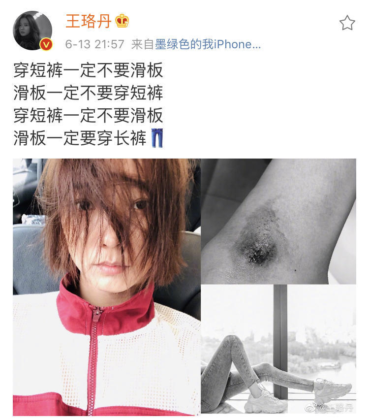 鹿晗膝蓋疑似流血鹿晗膝蓋疑似受傷，引發(fā)粉絲擔(dān)憂