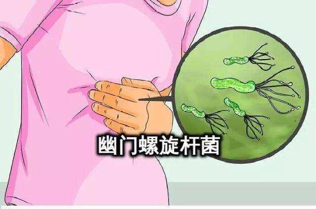 中國(guó)感染幽門螺桿菌的人有多少中國(guó)感染幽門螺桿菌的人數(shù)統(tǒng)計(jì)及其影響