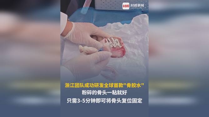全球首款骨膠水全球首款骨膠水可能是指某種特定類型的產(chǎn)品，但據(jù)我所知，目前市場(chǎng)上存在一些骨膠水的相關(guān)產(chǎn)品。