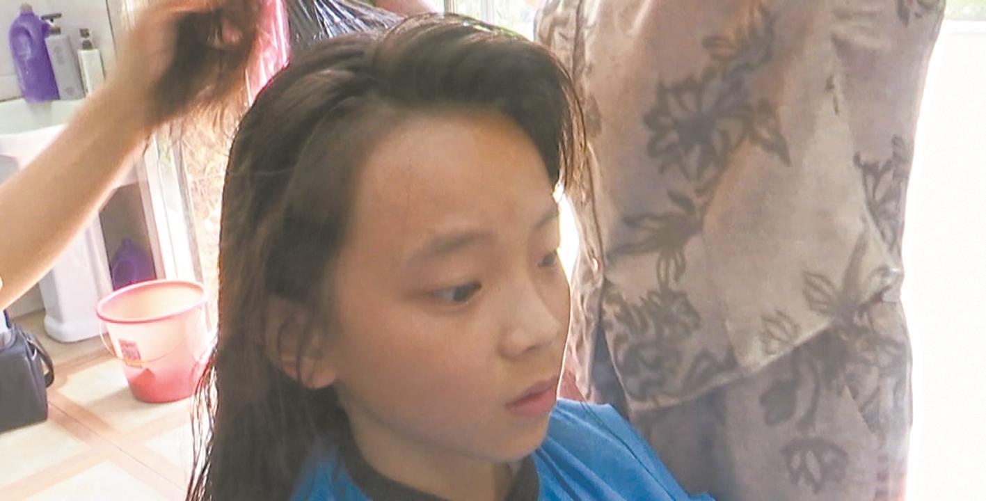 12歲女孩體內(nèi)長(zhǎng)頭發(fā)令人震驚！年僅12歲的女孩體內(nèi)竟然長(zhǎng)出頭發(fā)！醫(yī)生揭示背后的驚人真相！