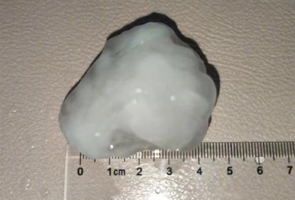北京為何突降巨型冰雹北京突降巨型冰雹的原因是多方面的，主要包括天氣系統(tǒng)和地形條件的影響。以下是具體原因