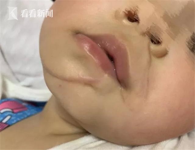 月嫂把寶寶摔了怎么賠償月嫂把寶寶摔了怎么賠償？全面解析賠償事宜