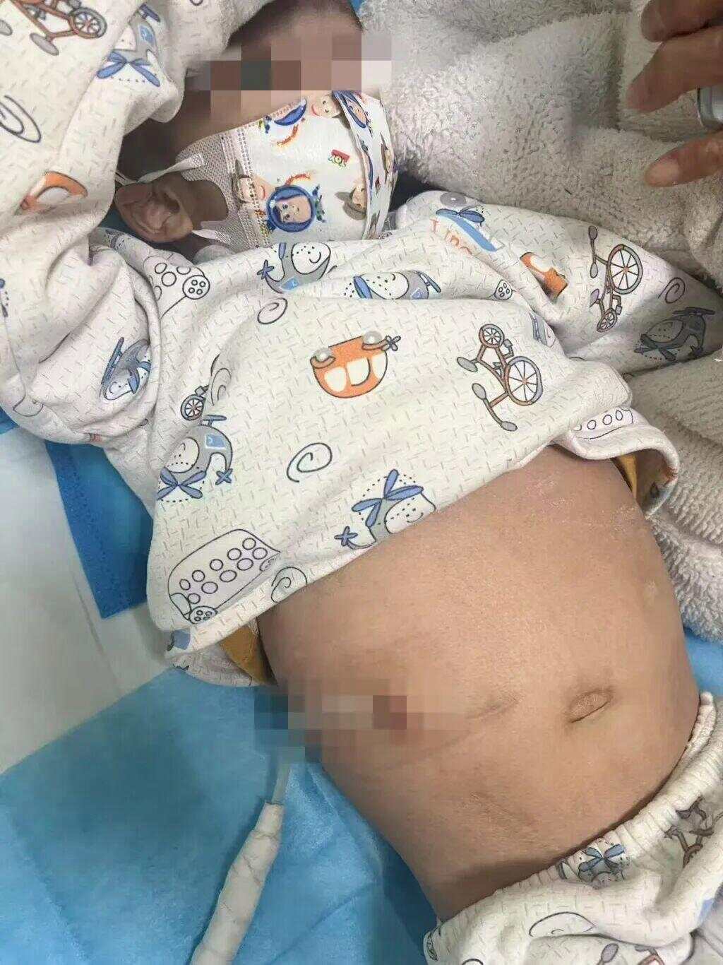 試管嬰兒患腎病 父母要求醫(yī)院擔全責試管嬰兒患腎病，父母要求醫(yī)院承擔全責，深度探討與理解